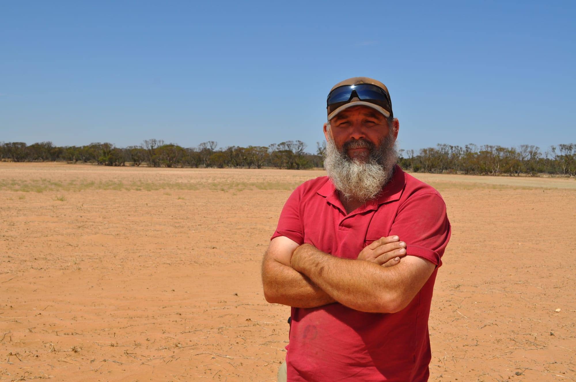 It’s getting hairy